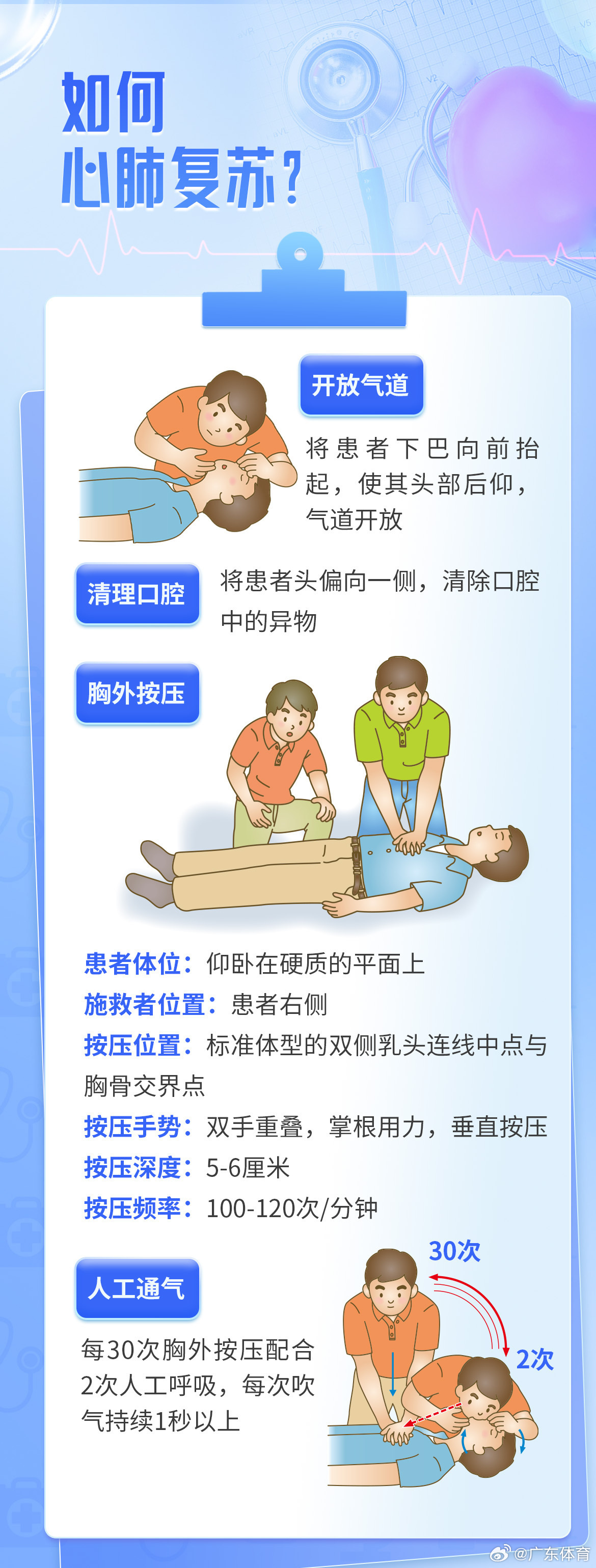 心跳骤停的家庭急救步骤与指南